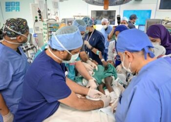 نجاح فصل التوأم السيامي البوركيني “حوّى وخديجة”